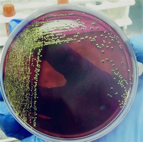 Escherichia coli colonies on EMB agar appear | Dextrose Technologies Pvt. Ltd