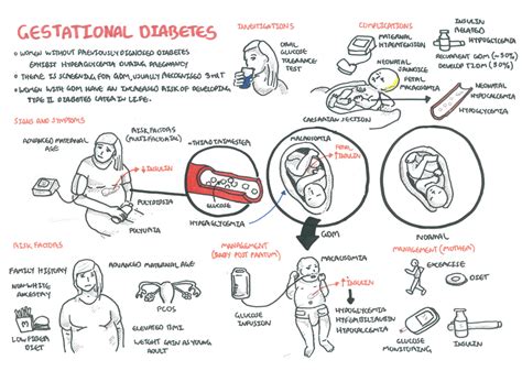 Gestational Diabetes - Armando Hasudungan