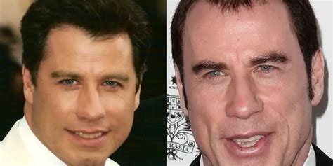 Is John Travolta Bald, And Why? - Hair System