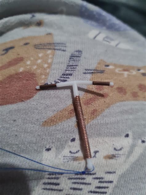 I pulled out my copper iud : r/CopperIUD