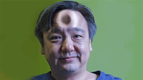 ‘Bagel Head’ Forehead Injections – Japan’s Hot New Beauty Trend (22 pictures) | Memolition