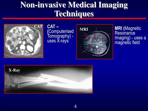 PPT - PET Scans PowerPoint Presentation - ID:6111551