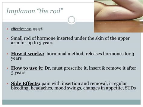 Ve Programming Control Starter Kit: Side Effects For Birth Control In Arm