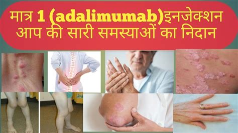 adalimumab injection uses in hindi and side effects - YouTube