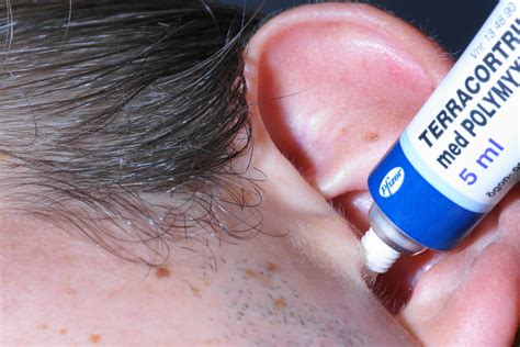 Ear Drops For Ear Infection - EAR DROPS FOR EAR INFECTION