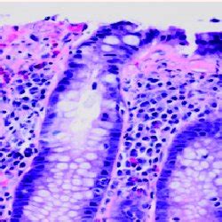 Colonic mucosa with preserved crypt architecture demonstrating... | Download Scientific Diagram