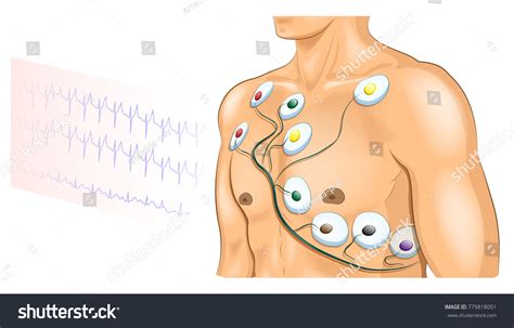 3,188 Ecg Electrodes' Images, Stock Photos & Vectors | Shutterstock