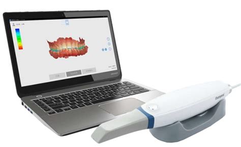 QuickScanIOS V2 Runyes Intraoral Digital Scanner