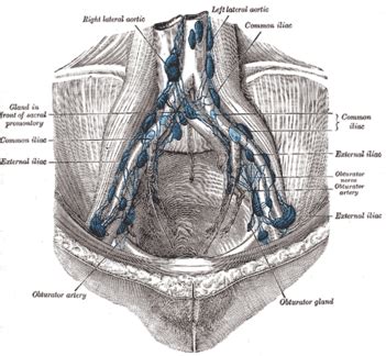 Retroaortic lymph nodes - Wikipedia