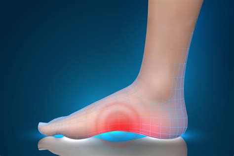 Orthotics & Foot Pain - Bymar Shoes & Orthotics