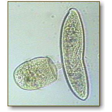 Didinium | Microbus Microscope Educational Website