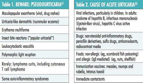 Management of Chronic Urticaria