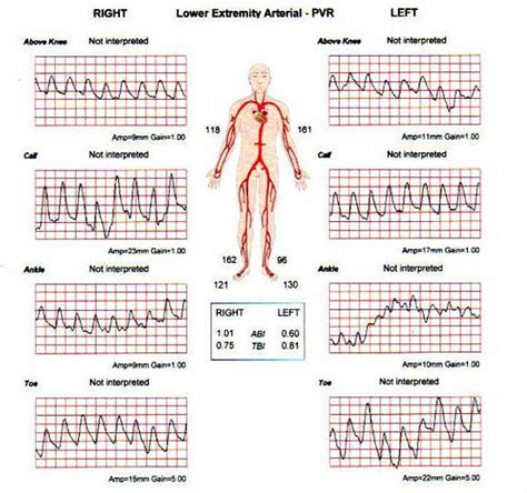 How To Perform A Thorough Vascular Exam