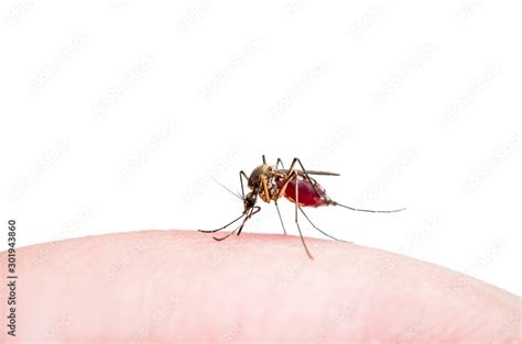 Dangerous Dengue Infected Mosquito Bite Isolated on White. Leishmaniasis, Encephalitis, Yellow ...