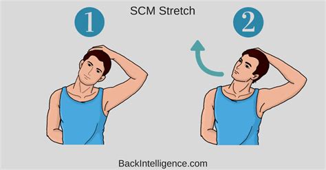 Sternocleidomastoid Stretch