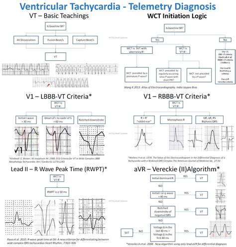 Ventricular Tachycardia Algorithm