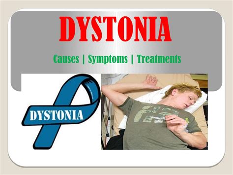 Dystonia: Causes, Types, Symptoms, and Treatments by lazoithelife - Issuu