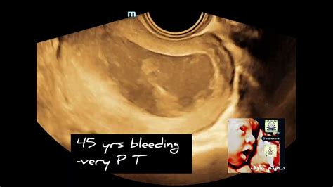 Ultrasound, Msc, Development