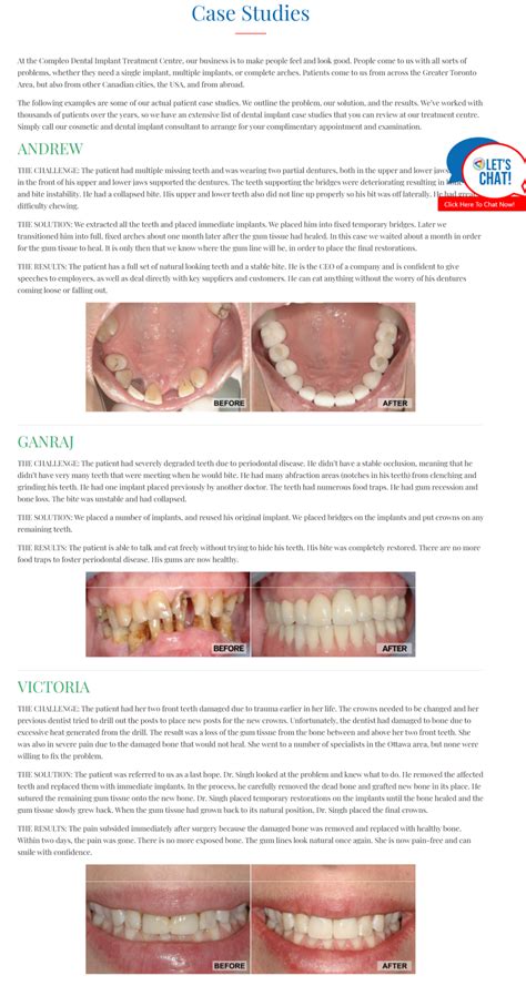 How to Build a Dental Case Study Page