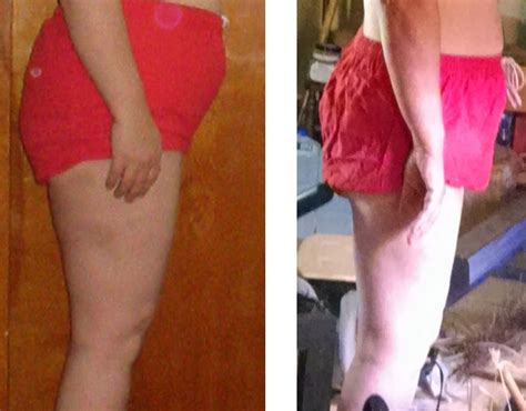 Leg photos before and after — MyFitnessPal.com