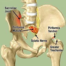 5 Ways to Treat Sacroiliac Joint (SI Joint) Pain