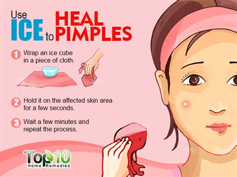 How to Get Rid of Pimples Fast | Top 10 Home Remedies