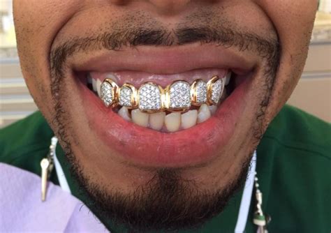 Grillz teeth near me