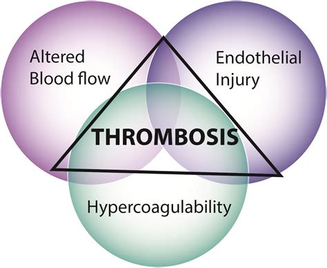 Virchow’s triad – eClinpath