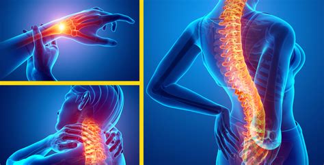 Ergonomics training key to RSI awareness and pain prevention | Workers ...