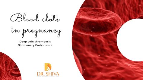 Blood Clots During Pregnancy (DVT/PE) | Blood Clots While Pregnant