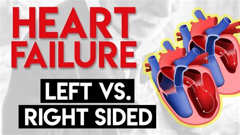 Left vs Right Heart Failure | Heart Failure (Part 3) - YouTube