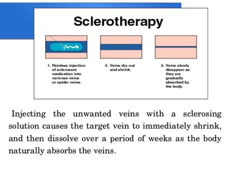 Sclerosing agents