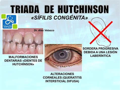 TRIADAS MÉDICAS ~ Dr. Alex Velasco