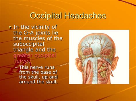 Occipital Neuralgia Headache