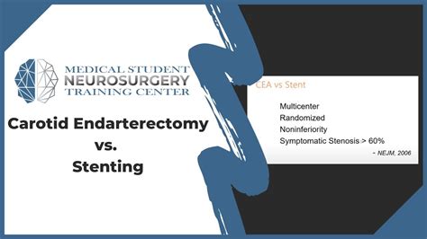 Carotid Endarterectomy vs. Stenting - YouTube