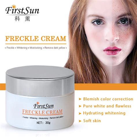 Freckle Removal Cream Day Creams Moisturizers Anti Freckle Whitening ...