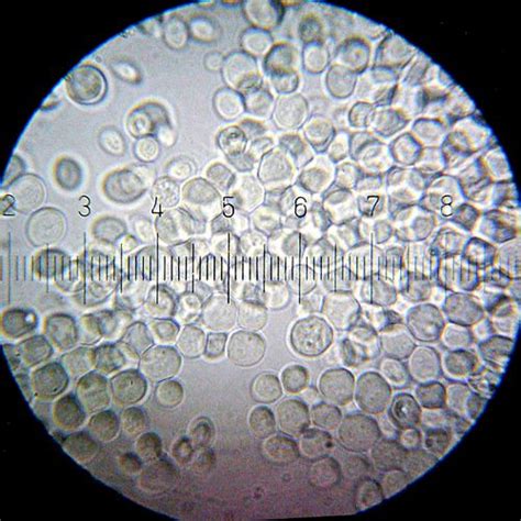 Saccharomyces cerevisiae - microbewiki