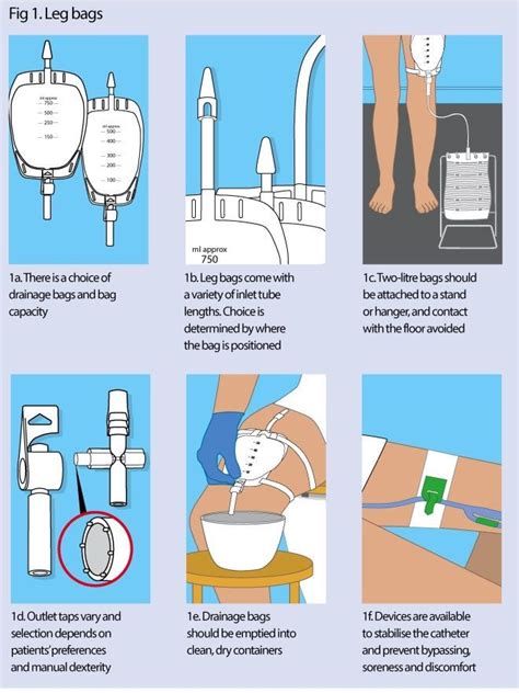 Urinary catheters 3: catheter drainage and support systems | Nursing Times | Catheter bag, Foley ...