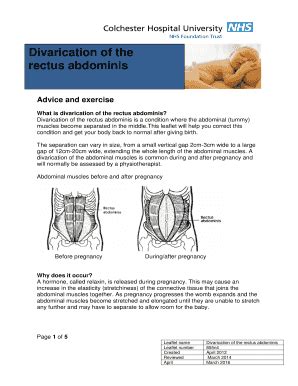 Fillable Online Divarication of the Fax Email Print - pdfFiller