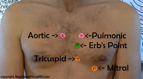 Auscultating the Heart | Nursing school tips, Nursing school, Nursing ...