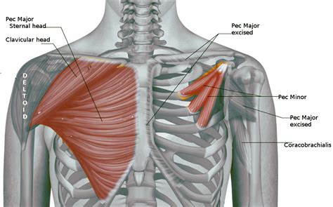 The pectoralis major clavicular and... - NeuroKinetic Therapy