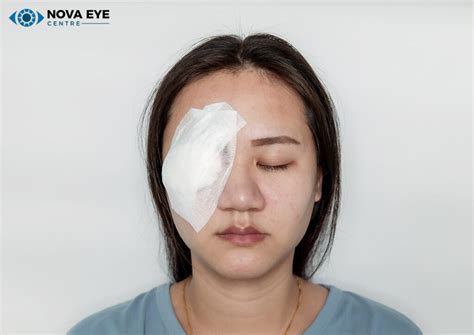 Preparing for Eye Surgery: Tips & Recovery | Nova Eye Centre