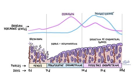 增生性子宫内膜 - MyPathologyReport.ca