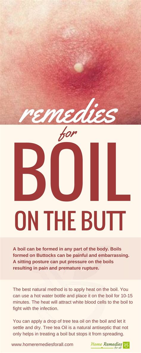 What Causes Boils On Buttocks - How To Get The Core Out Of A Boil What To Do - But what causes ...