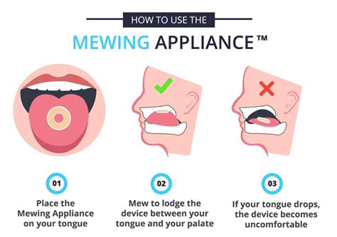 Mewing Appliance - A Device to Improve Your Facial Appearance | Jawline exercise, Good jawline, Mew