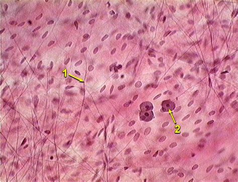 Unknowns: Connective Tissue