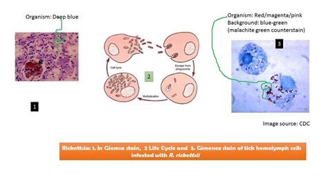 Rickettsia: Introduction, Morphology, Pathogenesis, Complications, Labora