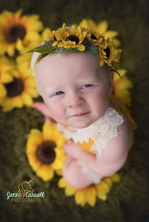 Sunflower Baby: Shining a Bright Light on Albinism - Jenn Carroll Photography | First birthday ...