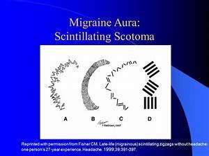 Migraine Aura without Headache Tips ~ Smith Migraine Institute Blog