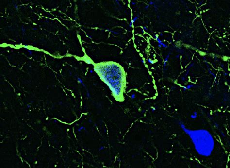 Endocrine Neurobiology Research Group | Institute of Experimental Medicine